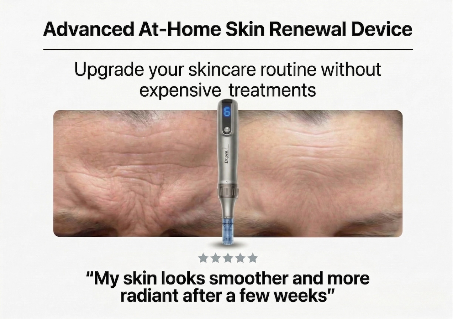 Dr. Pen M8S — Skin Renewal Device