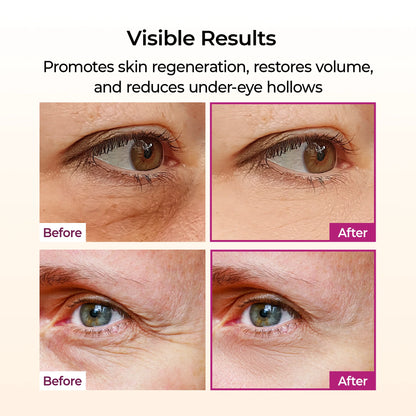 Calcium Multi Balm Stick | Instant Wrinkle & Under-Eye Plumping