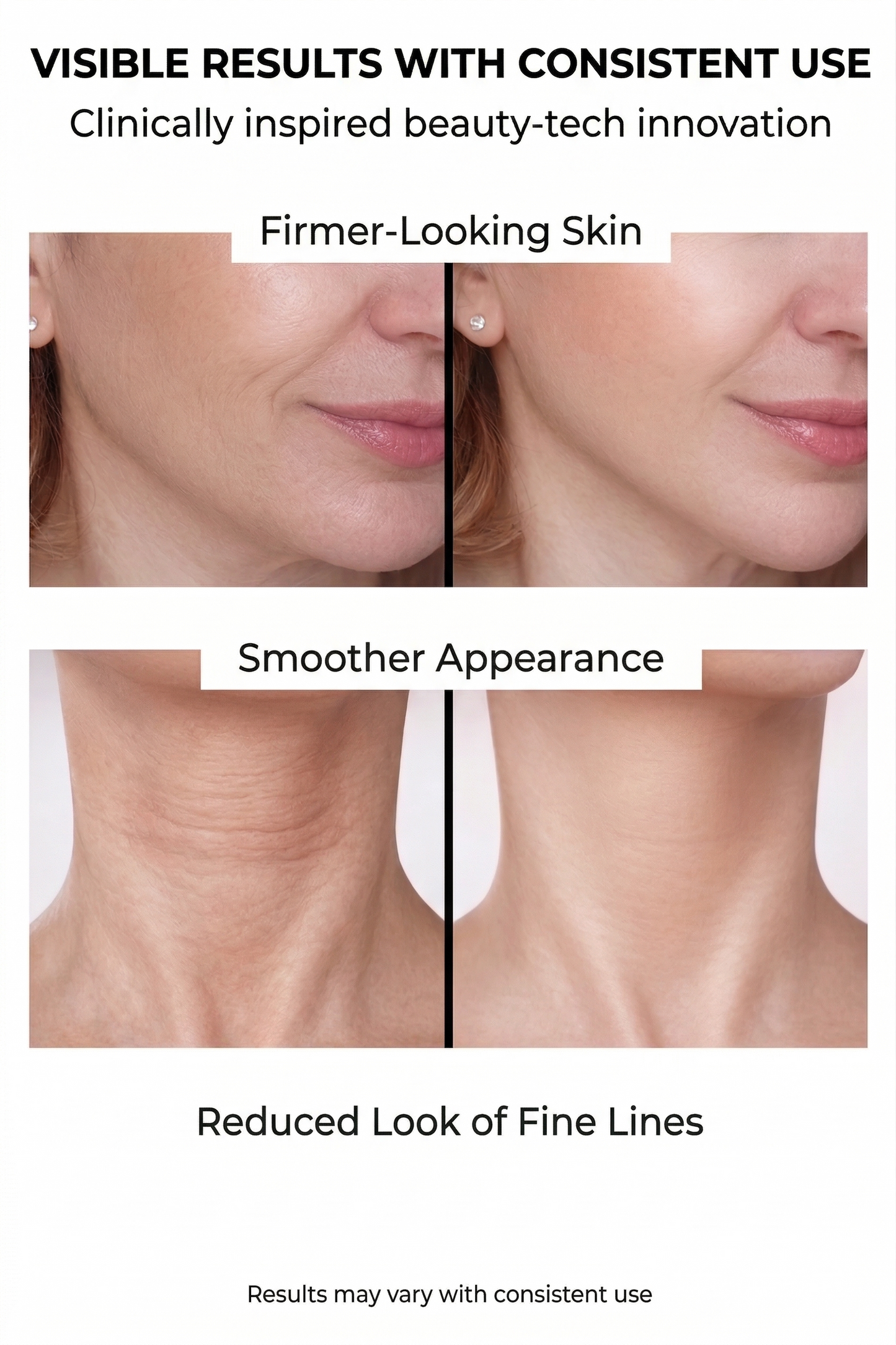 EMS Microcurrent Face Sculptor — Lift & Firm Your Jawline at Home